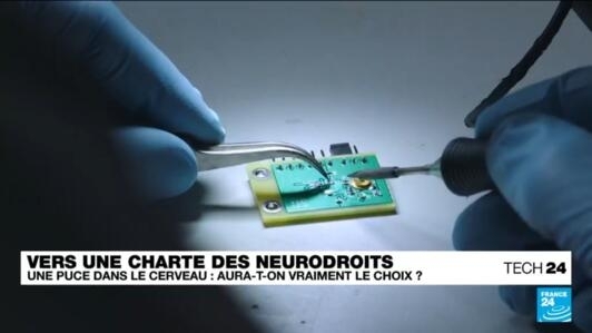 Puce dans le cerveau : et si un jour, nous n'avions plus le choix ? De l'utilité des "neurodroits" !